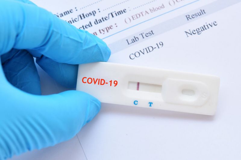 Отпада тестването за COVID-19 и на учениците в община Нова Загора
