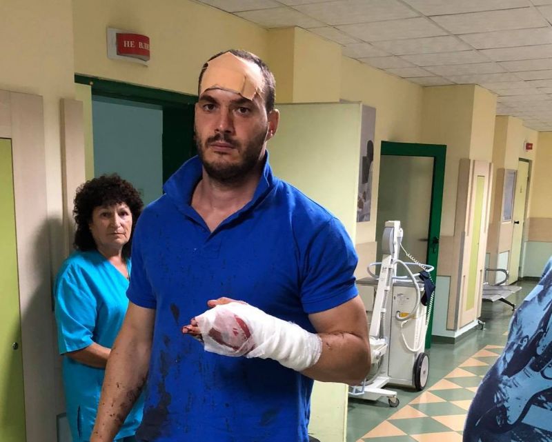 Нападнаха мъж с мачете във врачанското село Роман