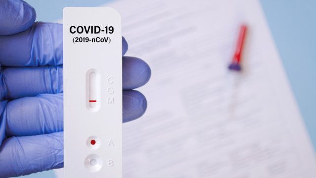 Лицата с положителен антигенен тест ще бъдат отчитани в портала за COVID-19