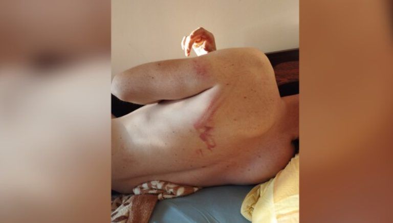 Мъж от Козлодуй се оплака от полицейско насилие: Биха ме с палка и ме унижаваха пред всички