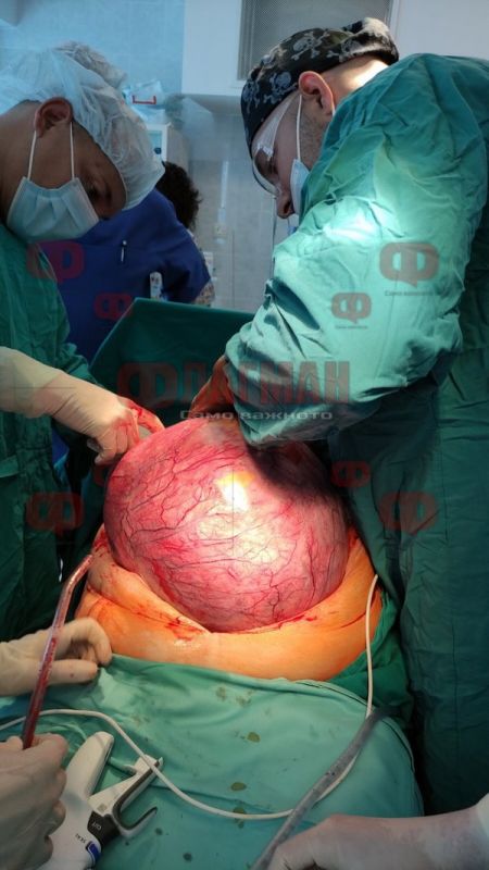 Операцията е била животозастрашаваща, изключително рискова, но лекарите са успели да я извършат без да засегнат други органи